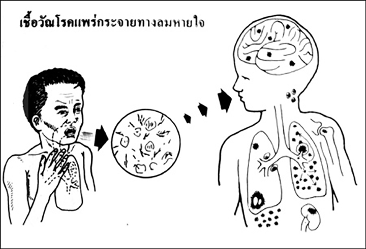 ႁၢင်ႈၾၢင် ၵၢၼ်ၸပ်းတင်းပဵၼ်မွင်ၶေႃႈ