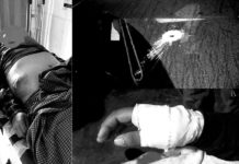 ၸုမ်းယိပ်းၵွင်ႈပႂ်ႉယိုဝ်းထႅဝ်ၵႃးတၢင်ႇၵူၼ်း ၼႂ်းၵႄႈ သႅၼ်ဝီ-ၵုၼ်လူင် ၵူၼ်းမိူင်းတၢႆ 6 ၵေႃႉ