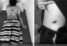 ၵူၼ်းတူၼ်ႈတီးၶီႇရူတ်ႉၶိူင်ႈၼႄၵၢင်ၸႂ် ၺႃးသိုၵ်းမၢၼ်ႈယိုဝ်းမၢတ်ႇၸဵပ်း၊ ၺႃးတီႉၼမ်