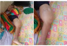 ႁႅင်းၵၢၼ်တႆးၵေႃႉၼိုင်ႈ ပဵၼ်မၢၵ်ႇႁဵင်း(ၶႅၼ်ႊသိူဝ်ႊ) လူဝ်ႇတၢင်းၸွႆႈထႅမ်ၵႃႈယူတ်းယႃ