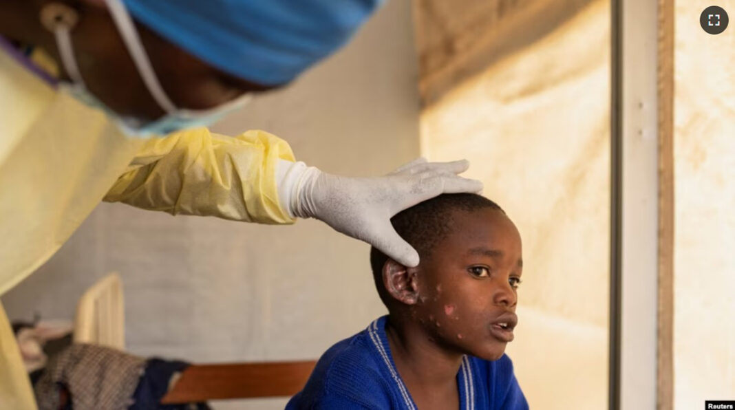 တၢင်းပဵၼ်မႁဵင်းလိင်း