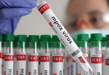 ႁွင်ႈၸႅတ်ႈထတ်း တၢင်းပဵၼ် ၸိူဝ်ႉမႅင်း mpox