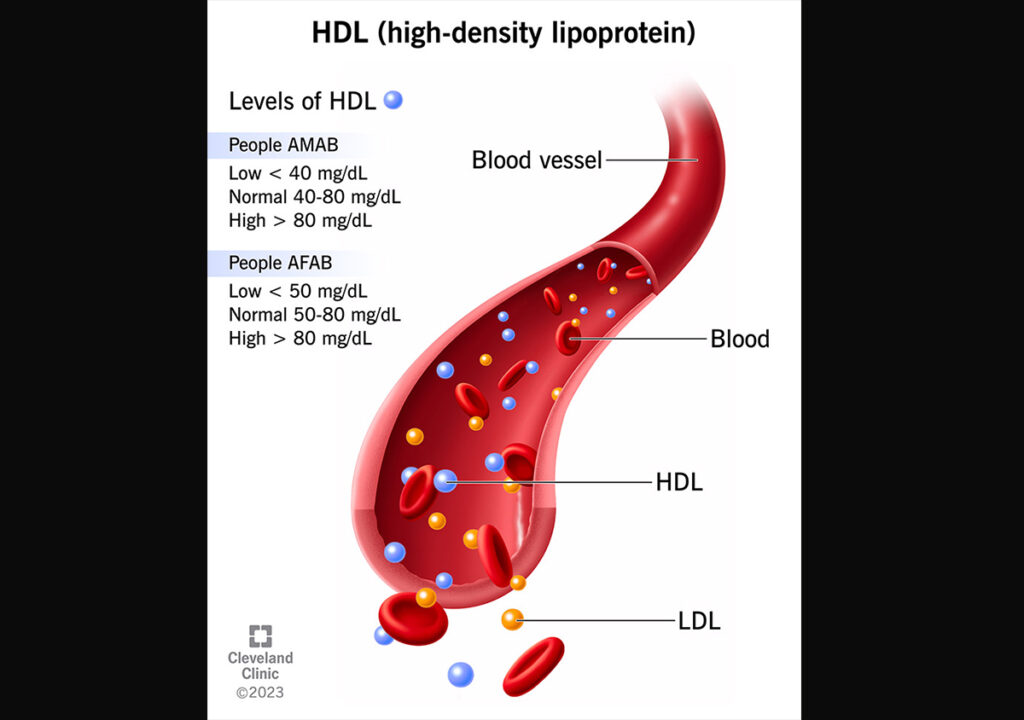 HDL