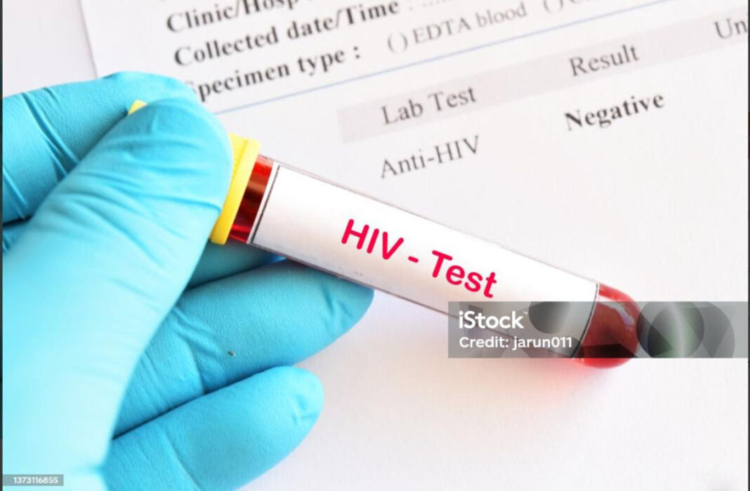HIV - Test