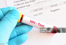 HIV - Test