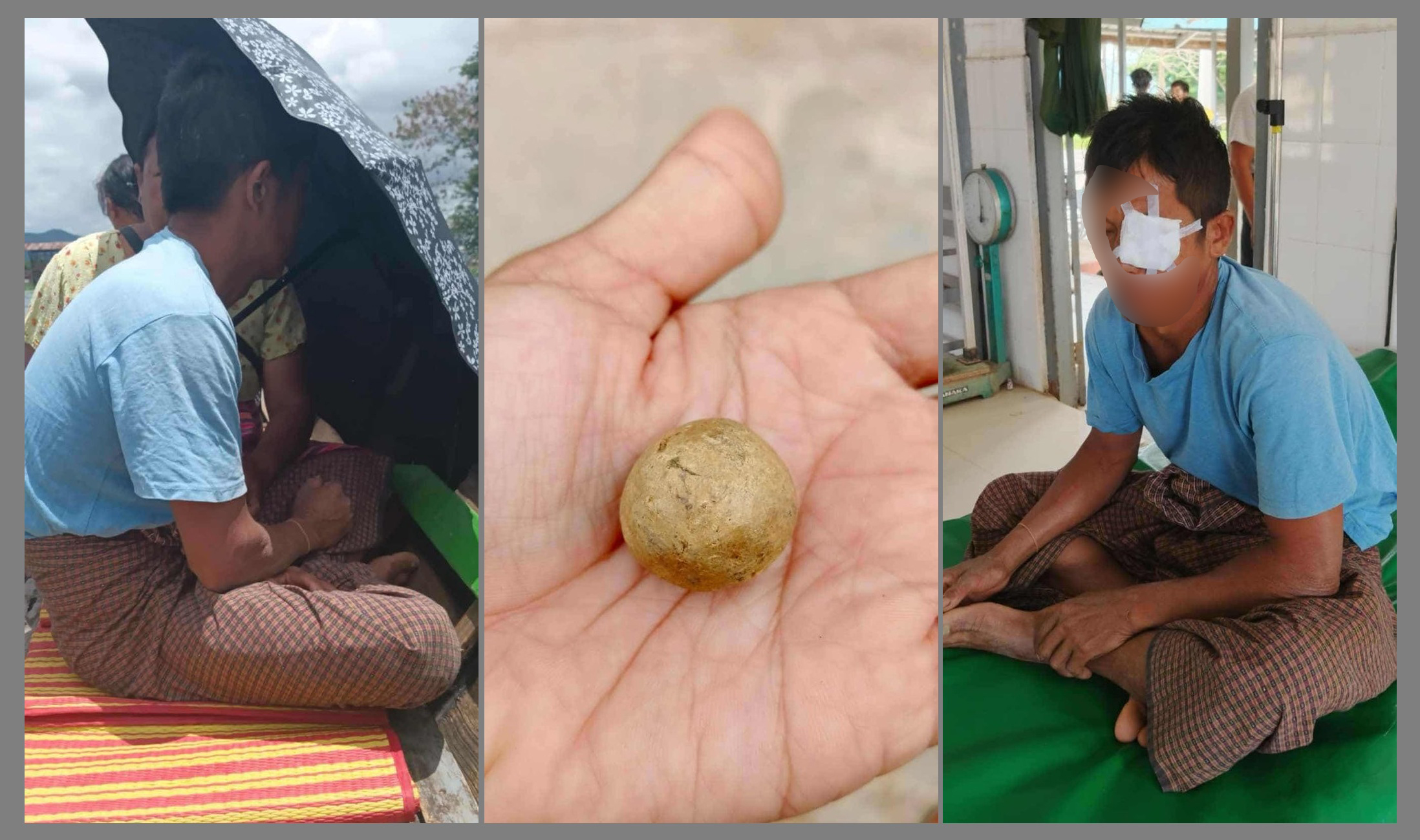 ထဝ်ႈၸၢႆးၽၢႆးႁိူဝ်းဢၢၼ်းၵႂႃႇႁဵတ်းၵၢၼ် ၺႃးၵၢင်ႇၵွၼ်ပႅၵ်ႇလၢၵ်ႇမႃးတိူဝ်ႉတ ...