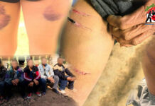 ၵူၼ်းမိူင်းဝၢၼ်ႈၸေႈ 5 ၵေႃႉဢၼ်ၺႃးသိုၵ်းၵဝ်ႈၵၢင်ႉတီႉဝႆႉၼၼ်ႉ ႁွတ်ႈထိုင်ႁိူၼ်းၶိုၼ်းယဝ်ႉ