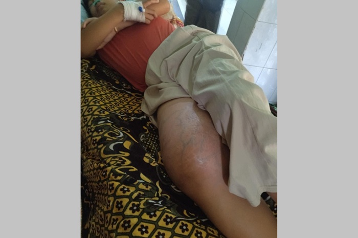 Muse Girl Cancer at Knee