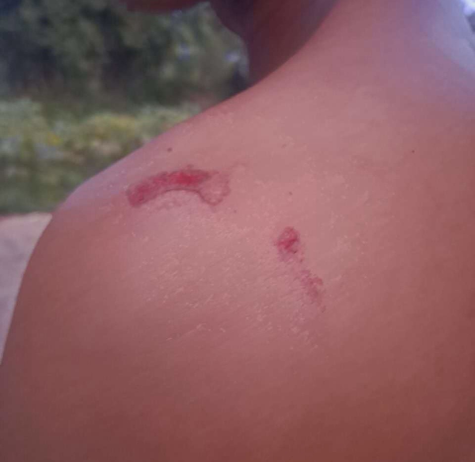 Villager at Lashio hit by MNDAA